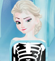 Elsa Bone Repair