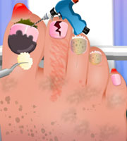 Nail Surgery Foot Spa